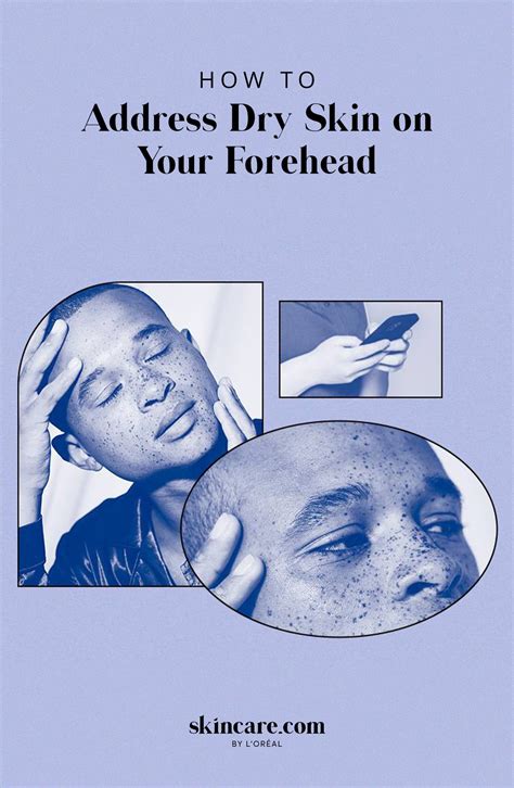 Dry Skin On Forehead Causes And How To Prevent It