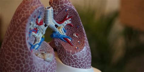 Qu Es Un Edema Pulmonar S Ntomas Causas Y Tratamiento Blog Saludonnet