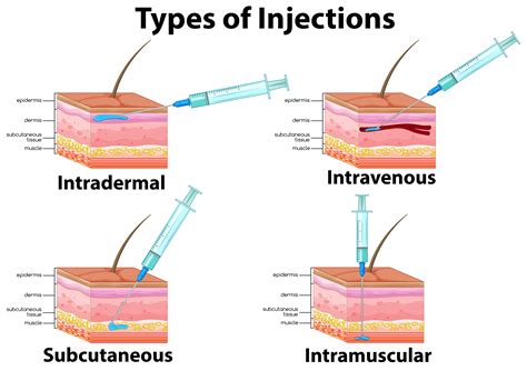 A Set Of Type Of Injections 358965 Vector Art At Vecteezy