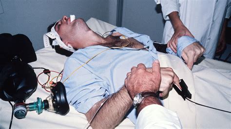 Electroshock Therapy 1950s