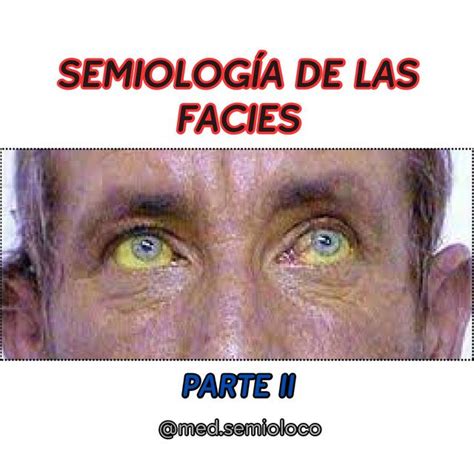 Semiología De Las Facies Víctor Rodriguez Botero Mioloco Udocz