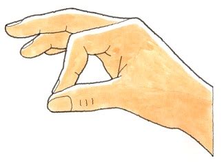 34 正中神経麻痺 （せいちゅうしんけいまひ） | 高次脳機能障害 ...