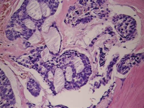 Eurocytology