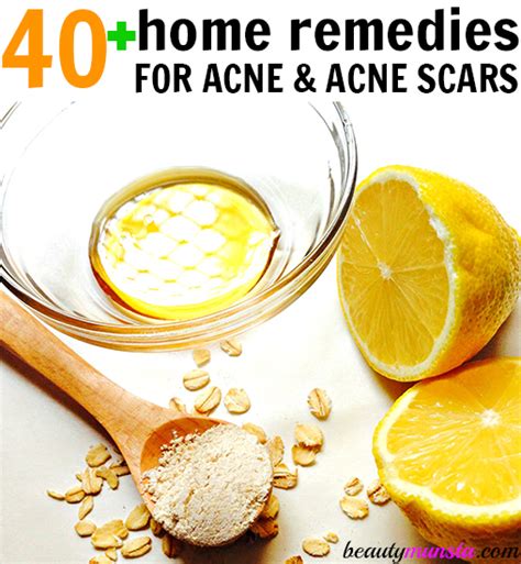 40 Diy Acne Remedies That Work Including Pimples Acne Scars