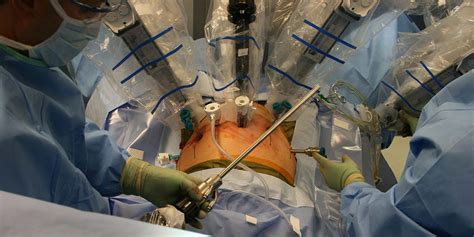 Robot Assisted Prostate Surgery Servo Magazine