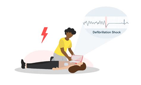 Importance Of Rapid Defibrillation And Survival Rate Avive Aed