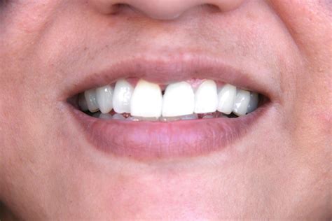 How to Have Nice Smelling Breath: 11 Steps (with Pictures)