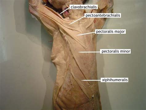 Many of these are discovered with prenatal ultrasound. Cat Muscles at State University of New York - Binghamton - StudyBlue