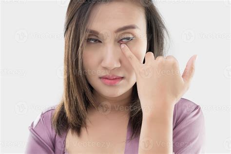 Woman Rubs Her Eye With A Finger 17696016 Stock Photo At Vecteezy