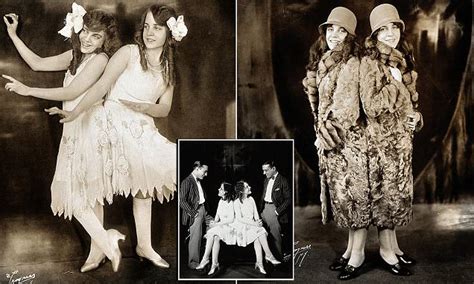Conjoined Twins Violet Were The Original Hilton Sisters In 1920s