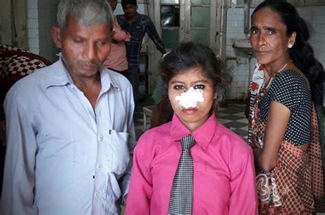 Attack Woman Attacked And Nose Bitten Off By Husband In India Over