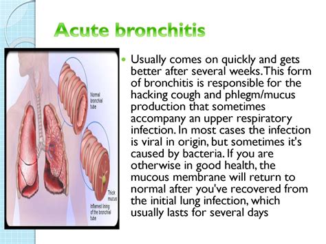 A Case Of Bronchitis Online Presentation