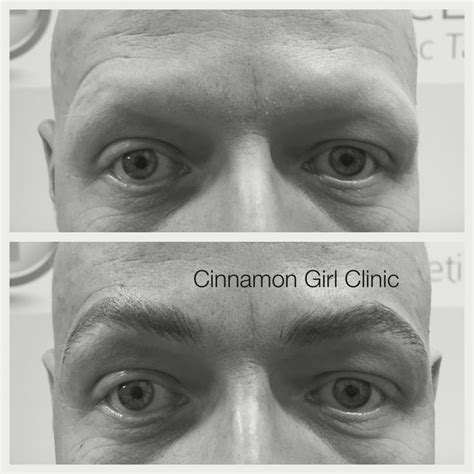 985 best Microblading images on Pinterest | Microblading ...