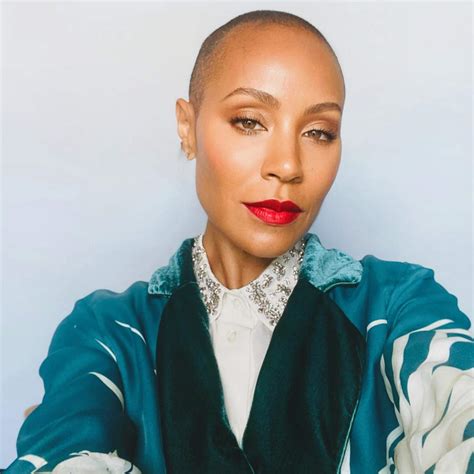 10 Celebrities Who Suffer From Alopecia Jada Pinkett Smiths Hair Loss