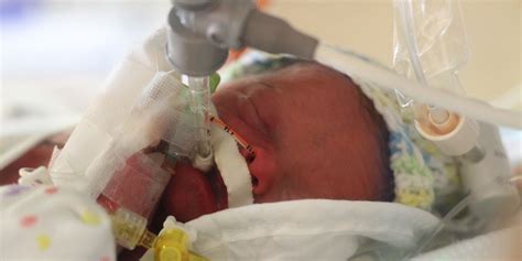 10 Things Parents Of Preemies Need To Know From Day One In The Nicu