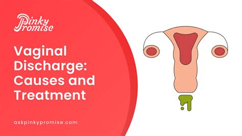 What Causes Vaginal Discharge Treatment For Vaginal Discharge My Xxx