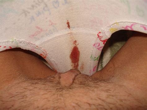 Virgin Pussy Menstruation Blood Which Out Porn Archive 100 Free