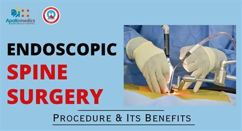Endoscopic Spine Surgery Procedure And Its Benefits Apollomedics