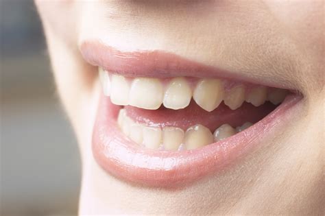 To discolor, soil, or spot: The Best Ways to Remove Nicotine Stains From Teeth | Our ...