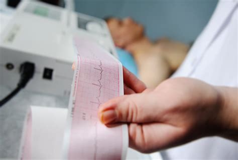 Ekg Elektrokardiografi Prosedur Risiko Dan Perawatan
