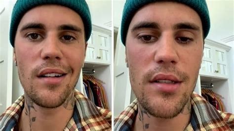 Justin Bieber On Ramsay Hunt Syndrome Recovery ‘this Storm Will Pass