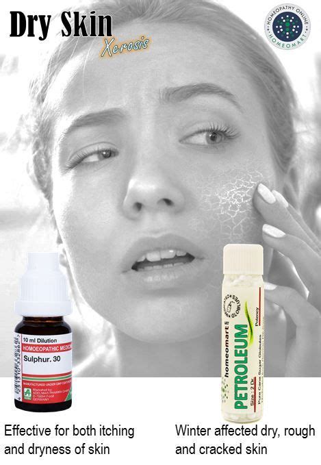 Top Doctor Recommended Homeopathic Medicines For Dry Skin Xerosis In