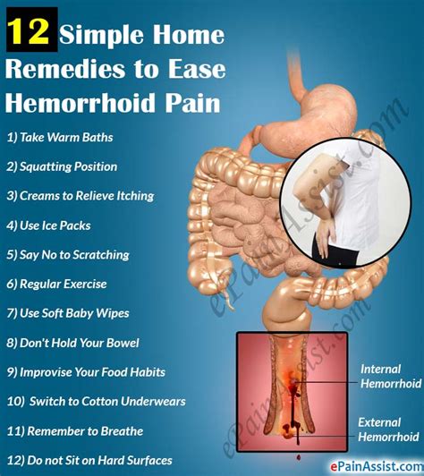 12 Simple Home Remedies To Ease Hemorrhoid Pain