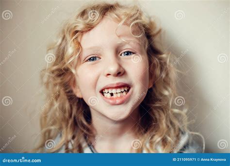 Closeup Of Smiling Caucasian Blonde Girl Showing Her Missing Lost Milk