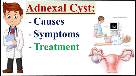 Adnexal Cyst Causes Symptoms And Treatment Of Adnexal Cyst Youtube