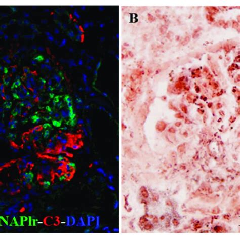 Photomicrographs Of Histological Staining For C3 Naplr And Plasm Download Scientific Diagram