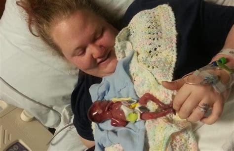 Mother Shares Powerful Photos Of Baby Miscarried At Weeks He Was