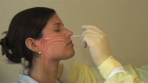 In fact, australian guidelines say swabs should only go a few centimetres up. COVID-19: Doctor explains how the nasal swab procedure ...