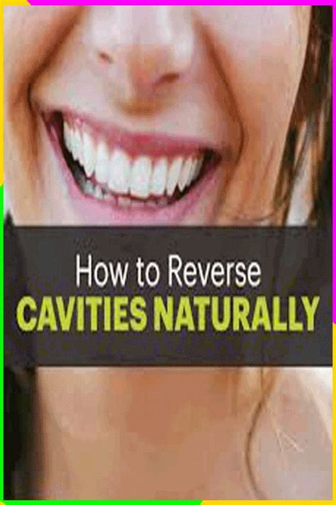 How To Reverse Cavities Naturally In 2020 Reverse Cavities Heal Cavities Tooth Cavity