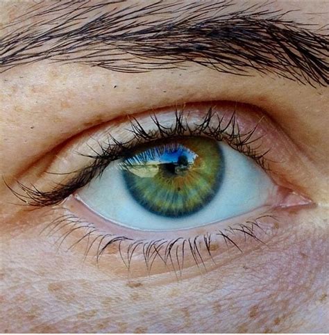 Byjo humphreys … there are actually three different types of heterochromia, central heterochromia being just one, and the most prolific. Central Heterochromia? And Iris Nevi : heterochromia