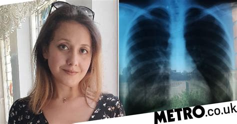 Womans Organs Are On Wrong Side Of Her Body Due To Rare Condition