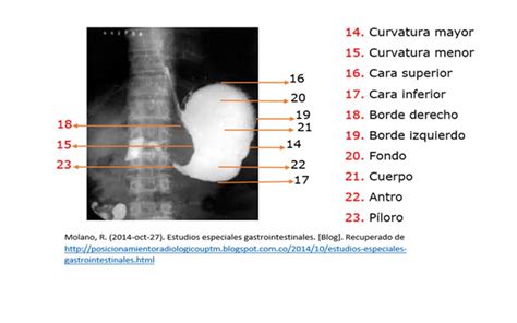 Blog De Anatomía Radiológica Humana Unad Grupo 15400340 2018 2018