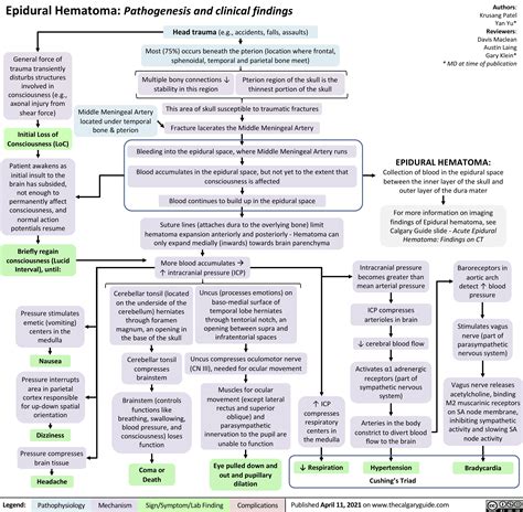 Epidural Hematoma Pathogenesis And Clinical Findings Calgary Guide