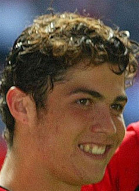 Cristiano Ronaldo Before And After Plastic Surgery 7 Celebrity