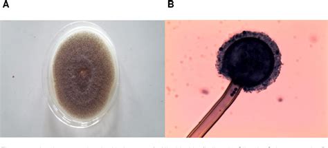 Figure 1 From Evaluation Of Micro Fungi Associated With Leaf Spot Of