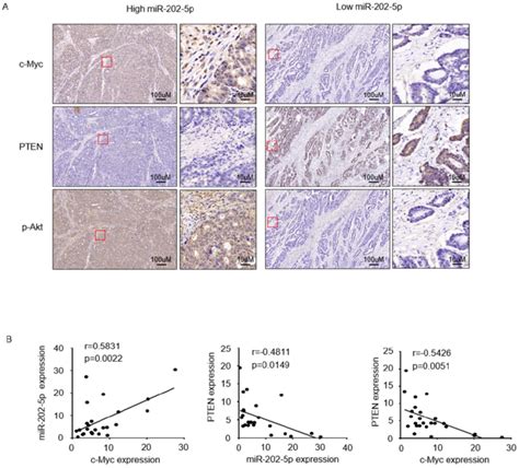 Clinical Relevance Of The C Myc MiR 202 5p PTEN Axis In Colorectal