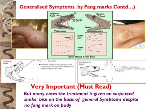 Find Out 35 List Of Snake Bite Fang Marks Images Your Friends Missed
