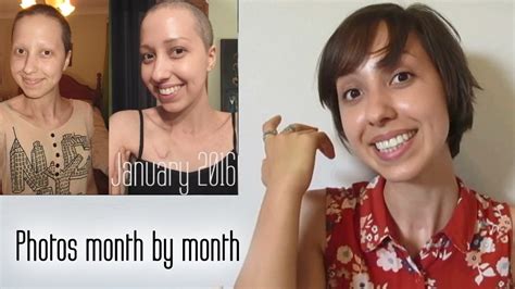 1 Year Of Hair Growth After Chemo And Cancer Youtube