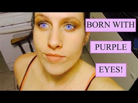 It allows scientists to engineer an individual cell with a specific neoantigen on its surface. I WAS BORN WITH PURPLE EYES! - YouTube