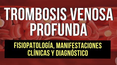 Trombosis Venosa Profunda Fisiopatolog A Manifestaciones Cl Nicas Y
