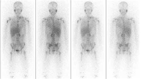New Imaging Technique Provides Hope For Deadly Childhood Cancer