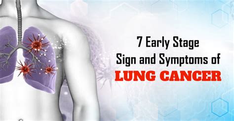 7 Early Stage Sign And Symptoms Of Lung Cancer