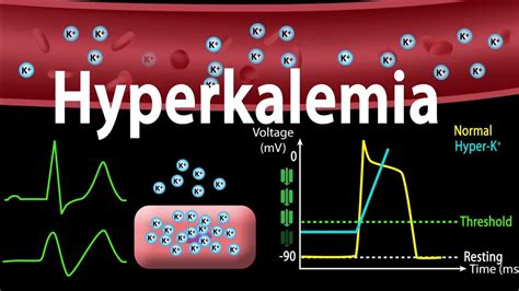 High Potassium Hyperkalemia Causes Symptoms And Treatment