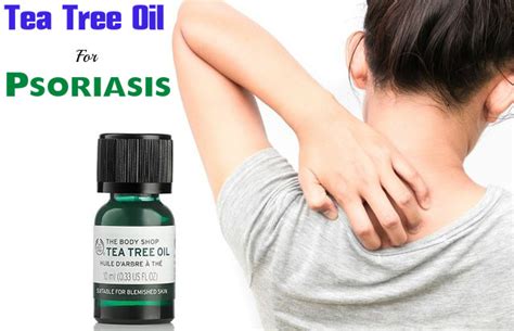 Tea Tree Oil For Psoriasis Is It Good How To Use Stylish Walks