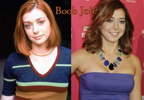 Alyson Hannigan Plastic Surgery Before And After