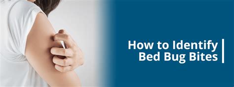 How To Identify Bed Bug Bites Pestech